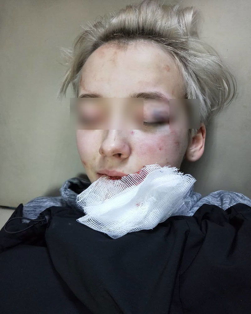 แก๊งวัยรุ่น 7 คน ชกสลบเหมือด