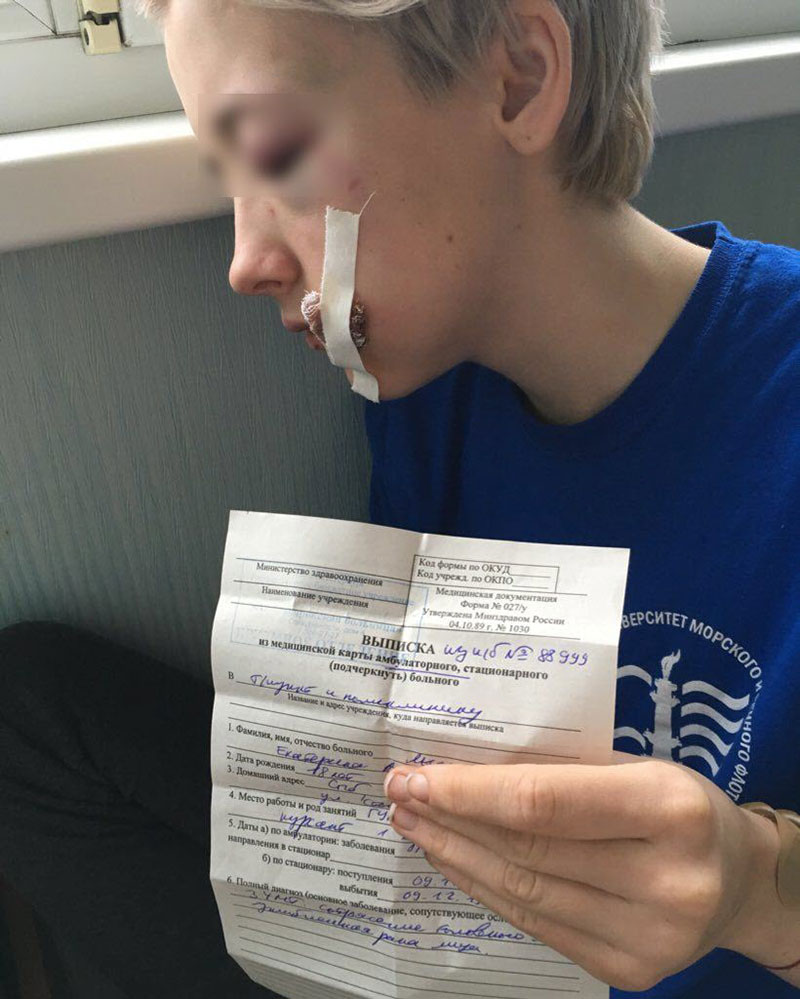 แก๊งวัยรุ่น 7 คน ชกสลบเหมือด