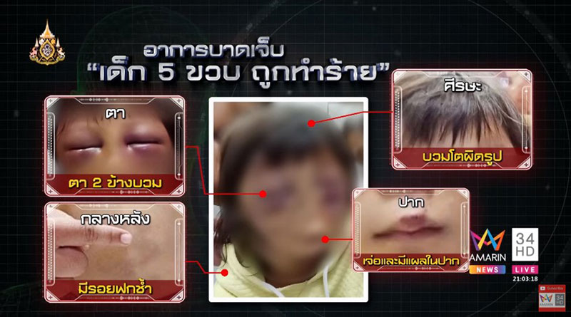 โป๊ะแตก