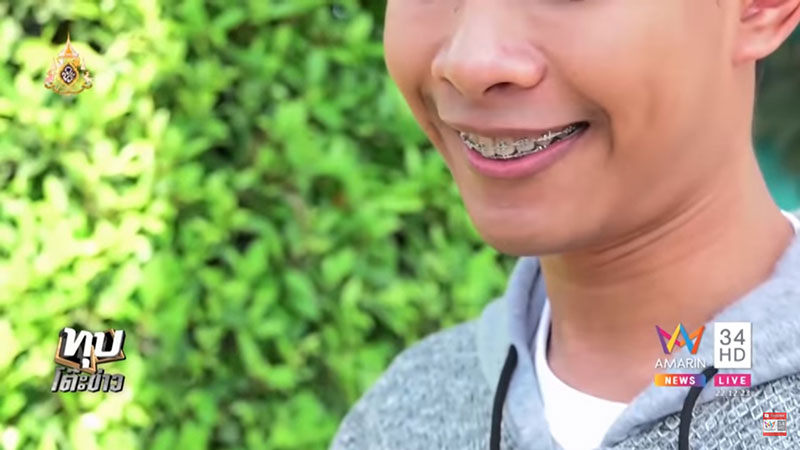 อดีตหนุ่มฟันเกระเนระนาด