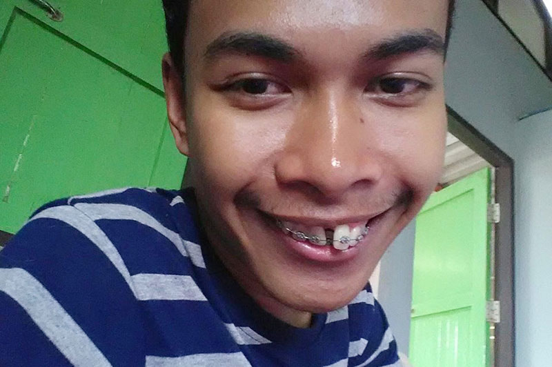 อดีตหนุ่มฟันเกระเนระนาด