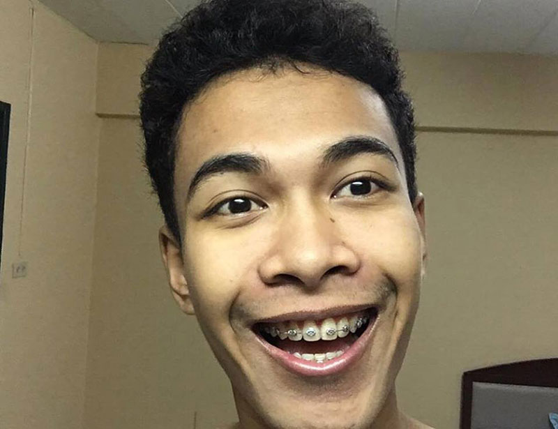 อดีตหนุ่มฟันเกระเนระนาด