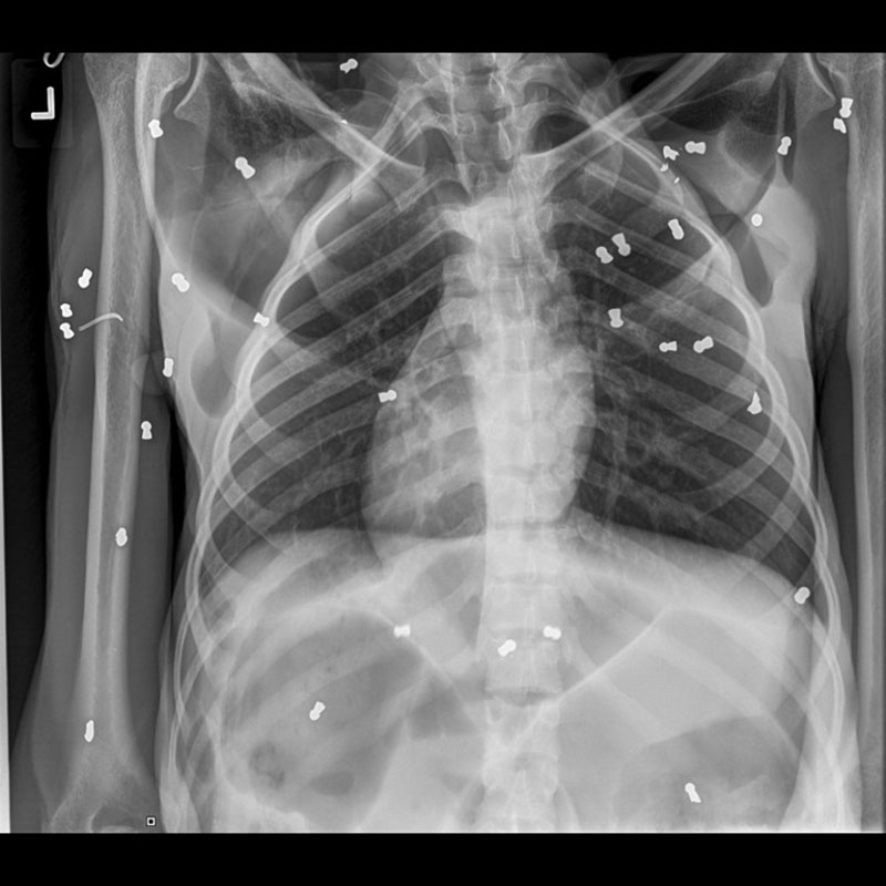 แม่อุรังอุตัง