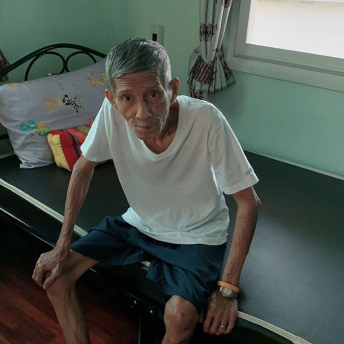 ตาซูบผอม