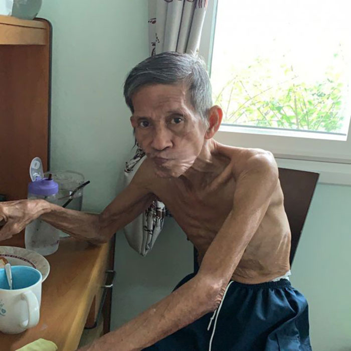 ตาซูบผอม