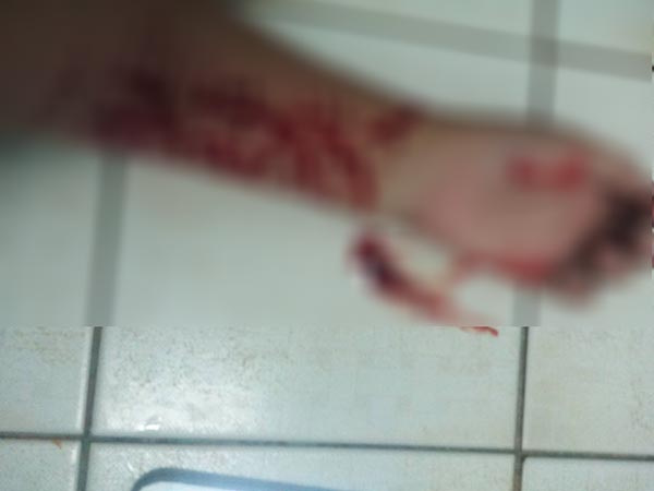 อัดคลิปกรีดแขนประชดรัก