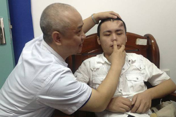 ปลูกจมูกคนไข้บนหน้าผาก