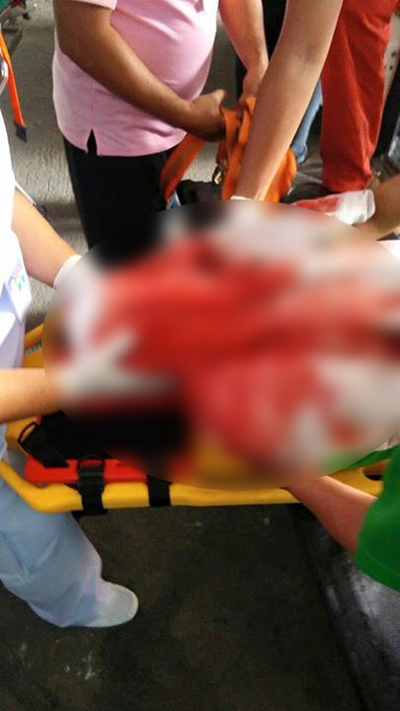 คนงานหญิงผมติดเครื่องจักร