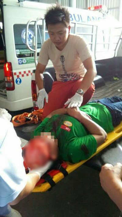 คนงานหญิงผมติดเครื่องจักร