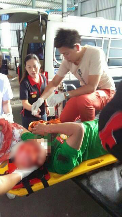 คนงานหญิงผมติดเครื่องจักร