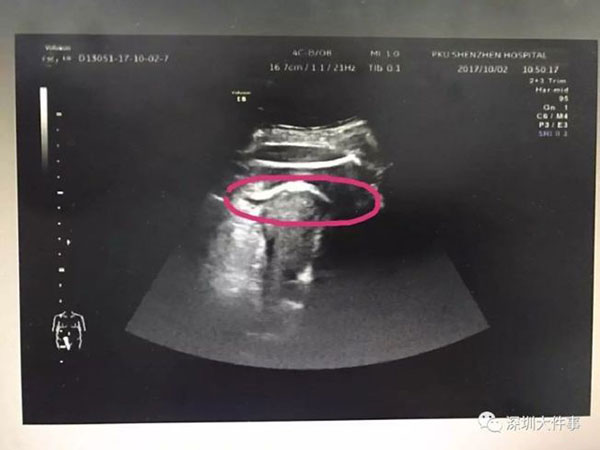 ลูกดิ้น