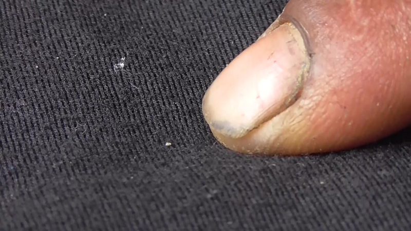 แมลงไชจากออกตัว