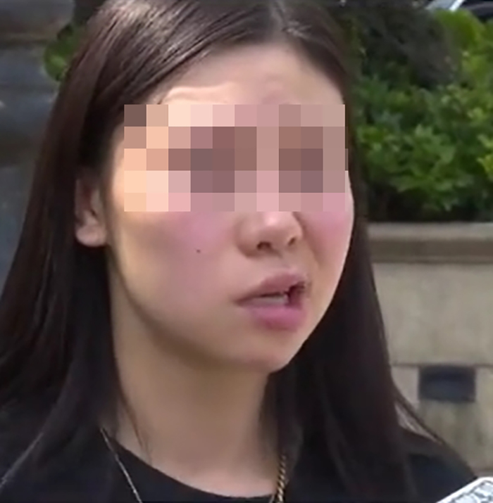 ฉีดฟิลเลอร์จนหน้าเบี้ยว