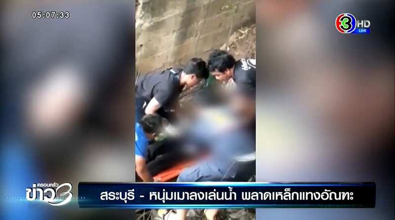 เหล็กเสียบก้นทะลุ