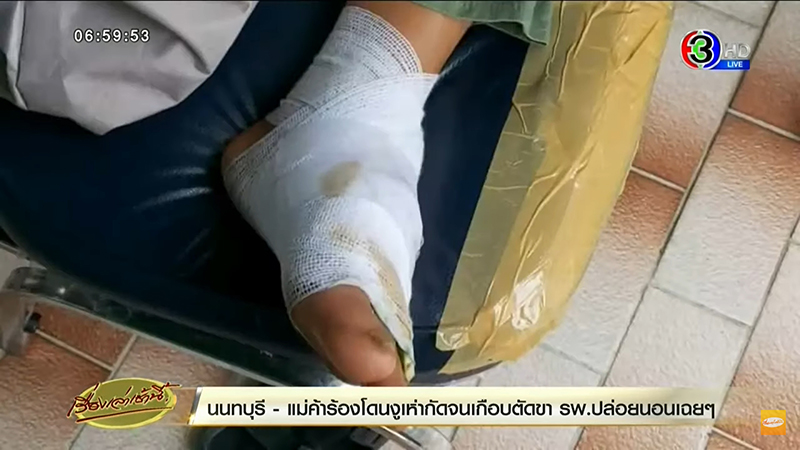 งูเห่ากัด