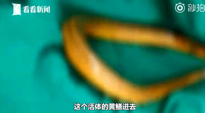 ปลาไหลเข้าก้น