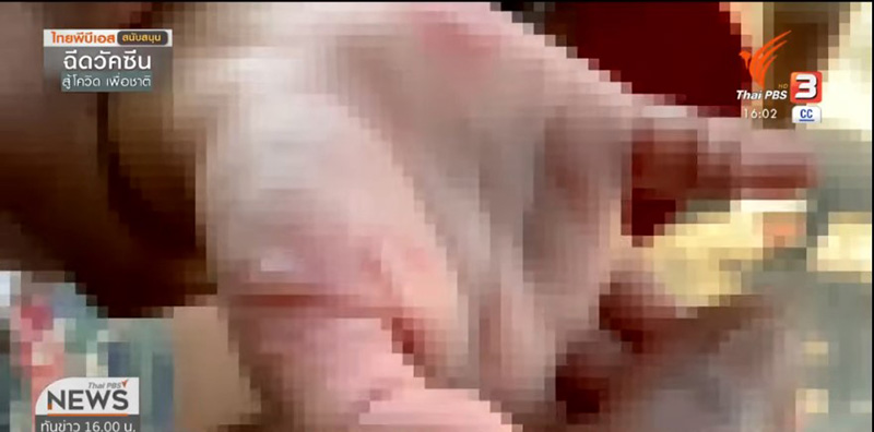 เจลแอลกอฮอล์