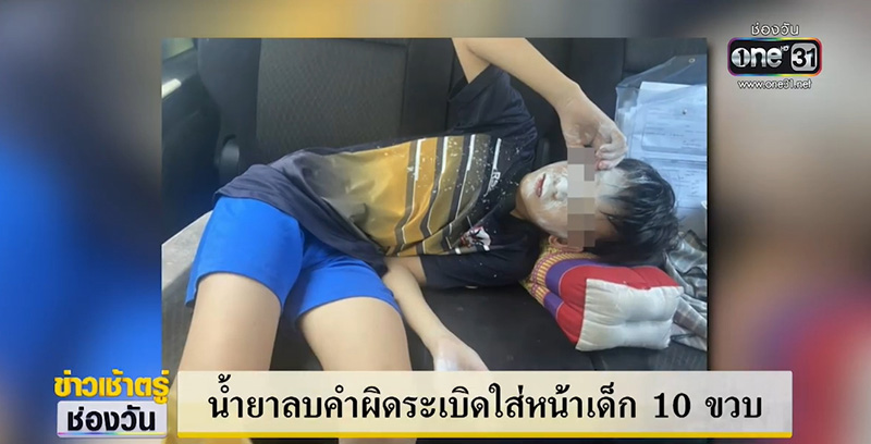 ลิควิดระเบิดใส่หน้า