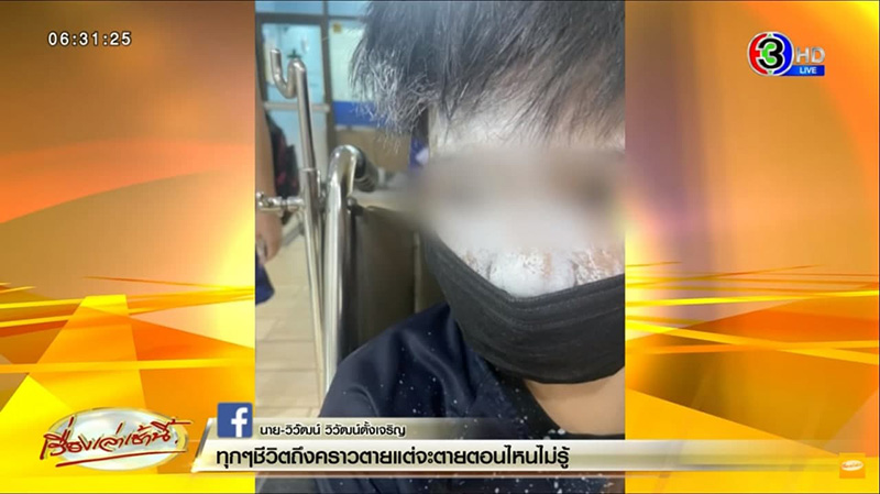 ลิควิดระเบิดใส่หน้า