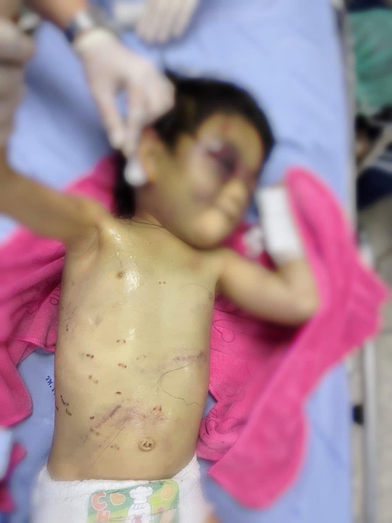 พ่อทำร้ายลูก