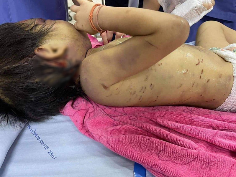 พ่อทำร้ายลูก