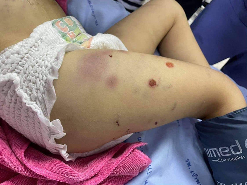 พ่อทำร้ายลูก