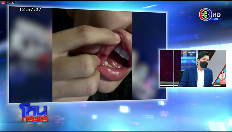 โหนกระแสเติ้ล ธนพล