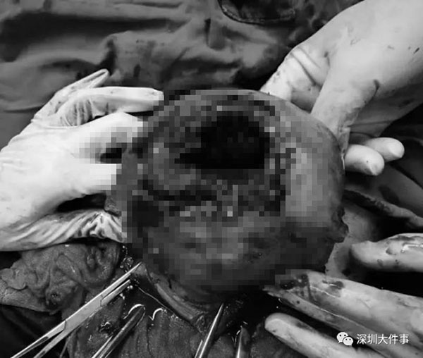 ลูกดิ้น