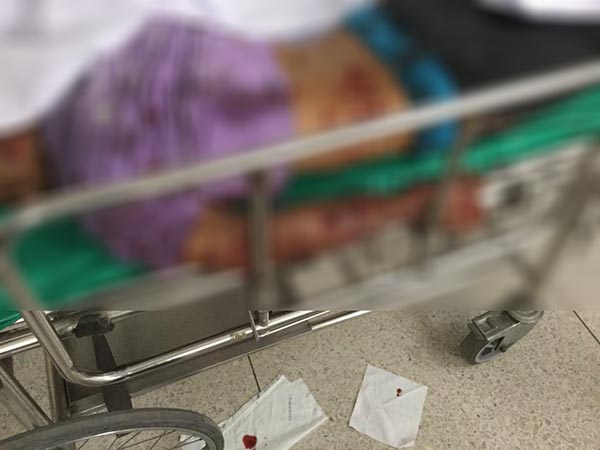 ระเบิดหน้าโรงเรียนตาบา 