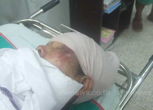 กะเทยโหดหลอกแม่เฒ่าวัย 60 ทุบหัวล้างหนี 