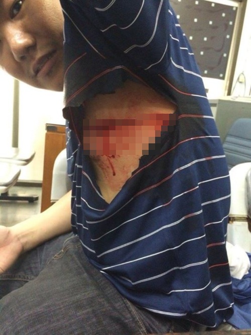 หนุ่มร้องถูกแท็กซี่ใช้มีดกรีดเละ เย็บ 30 เข็ม ทั้งที่ขับถูกปาดหน้าก่อน  