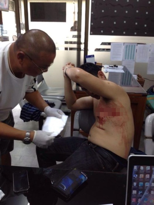 หนุ่มร้องถูกแท็กซี่ใช้มีดกรีดเละ เย็บ 30 เข็ม ทั้งที่ขับถูกปาดหน้าก่อน  