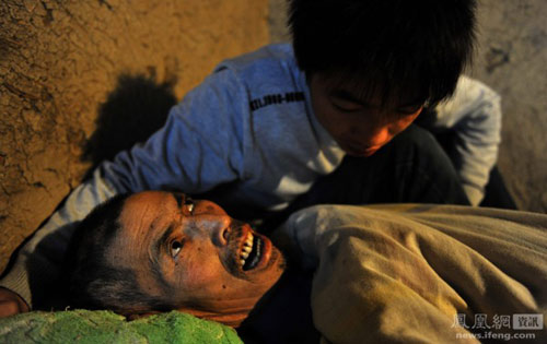 สุดกตัญญู! หนุ่มจีนทิ้งการเรียน ดูแลพ่อในวาระสุดท้าย