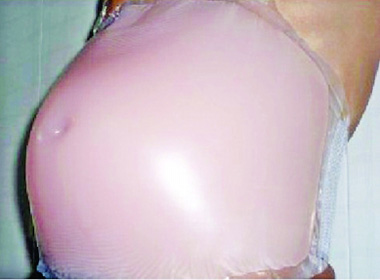 ซิลิโคนท้อง หลอกว่าตั้งครรภ์