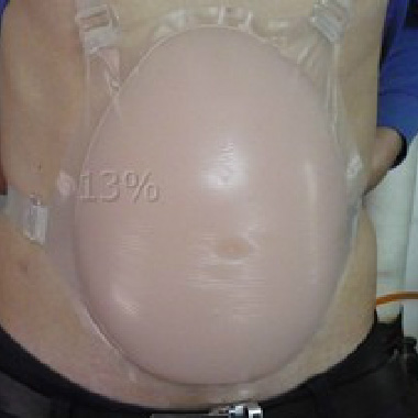 ซิลิโคนท้อง หลอกว่าตั้งครรภ์