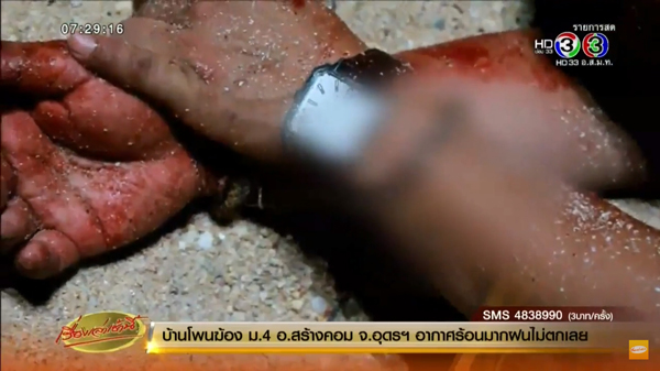 รปภ.โรงแรมดังพัทยา ถูกโจ๋ล็อกกุญแจมือ-รุมตีเลือดอาบ ไถเงิน 200