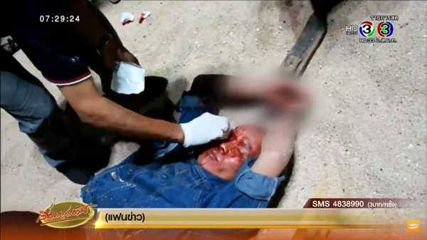 รปภ.โรงแรมดังพัทยา ถูกโจ๋ล็อกกุญแจมือ-รุมตีเลือดอาบ ไถเงิน 200