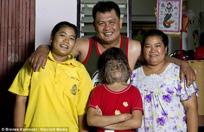 เด็กหญิงที่มีขนยาวที่สุดในโลก