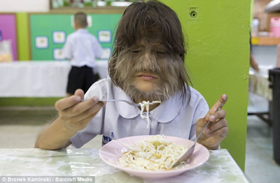 เด็กหญิงที่มีขนยาวที่สุดในโลก